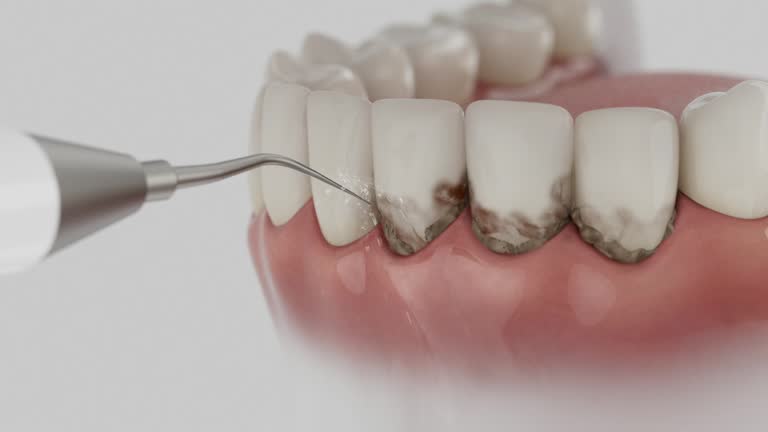 Trusted Dental Implants service in West Carson, CA - Dentist Open Now